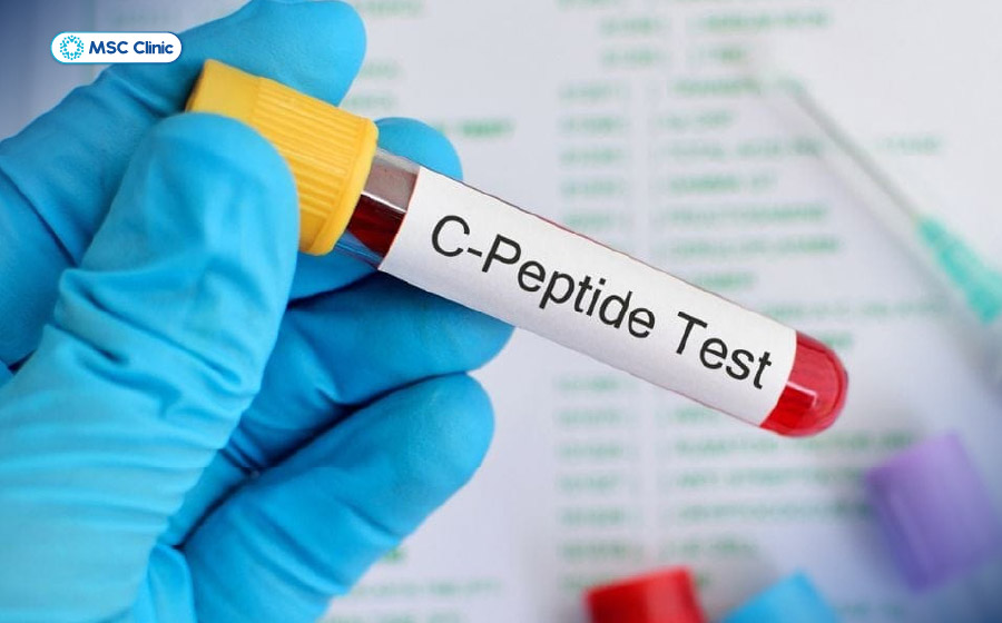 Xét nghiệm C-peptide đánh giá khả năng sản xuất Insulin ở tuyến tụy