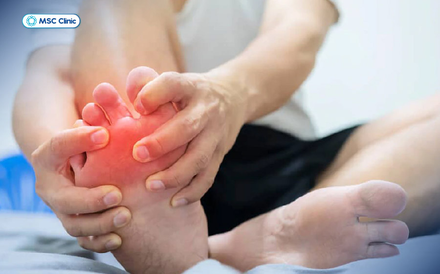 Các cơn đau và hạt tophi hình thành tại khớp khiến người bệnh vận động khó khăn