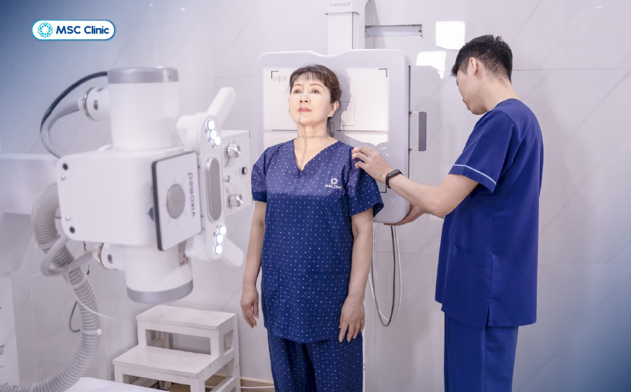 Chụp X-quang ngực thẳng đánh giá toàn bộ khung xương sườn