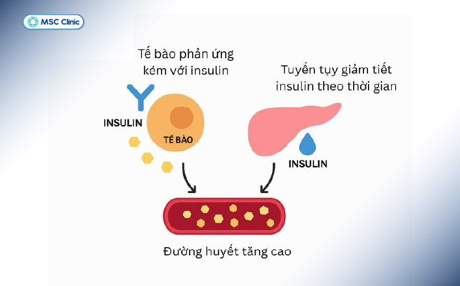 Cơ chế đề kháng insulin và tăng đường huyết ở tiểu đường tuýp 2