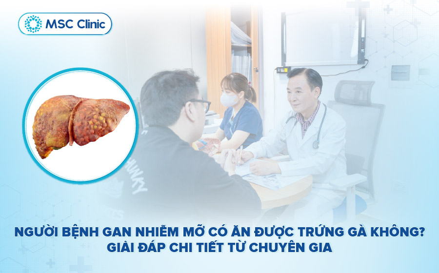 Bệnh gan nhiễm mỡ có ăn được trứng gà không? Cần lưu ý gì?
