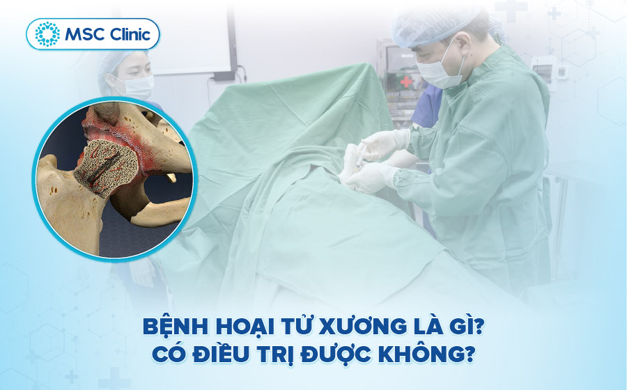 Bệnh hoại tử xương là gì? Có điều trị được không?