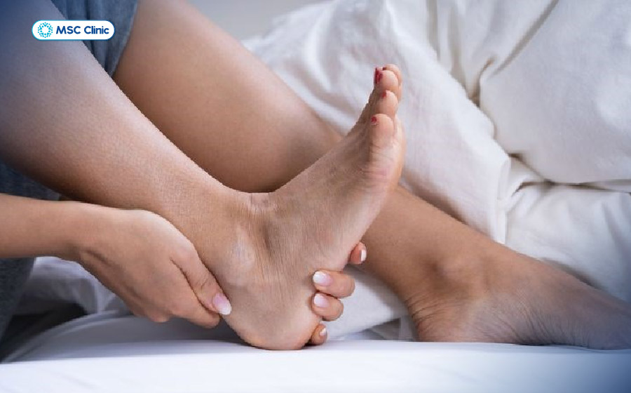 Các khớp nào thường bị bong gân? Dấu hiệu và cách phòng ngừa như thế nào? Các khớp nào thường bị bong gân? Dấu hiệu và cách phòng ngừa như thế nào?