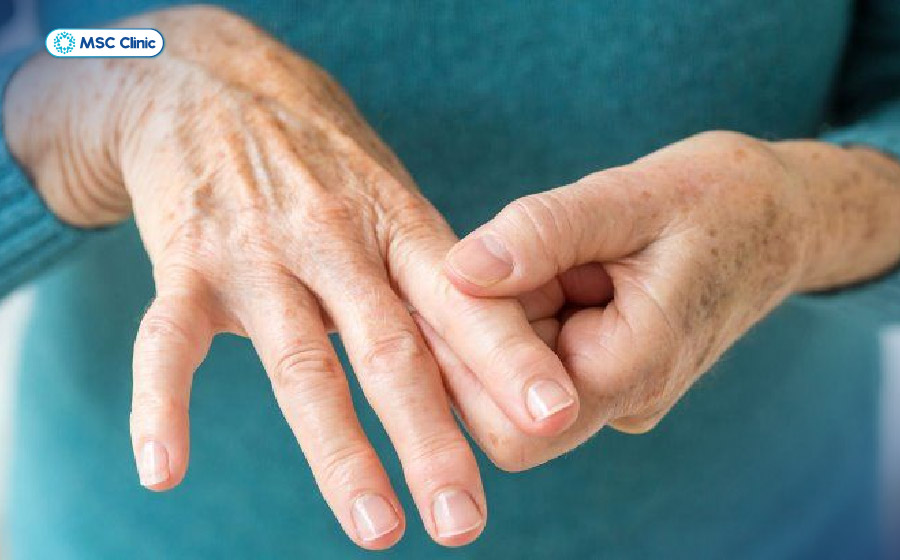 Cảm giác tê ran, châm chích ở các đầu ngón tay có thể liên quan đến rối loạn thần kinh và cần được kiểm tra để phân biệt với triệu chứng do tiểu đường Cảm giác tê ran, châm chích ở các đầu ngón tay có thể liên quan đến rối loạn thần kinh và cần được kiểm tra để phân biệt với triệu chứng do tiểu đường