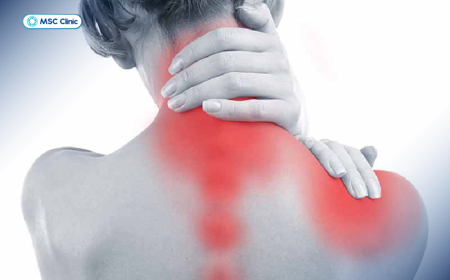 Đau cổ lan xuống vai, cánh tay, gây tê bì hoặc yếu cơ cần đi khám ngay