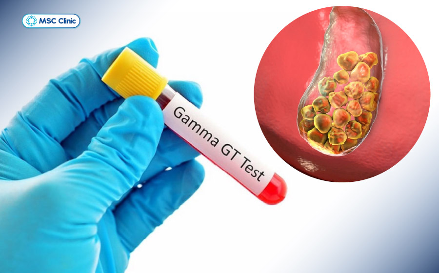 GGT thường được sử dụng để hỗ trợ đánh giá bệnh gan, đường mật