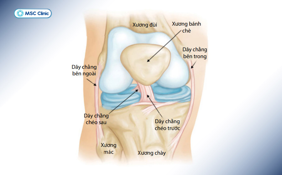 Hình ảnh mặt trước đầu gối phải (đã tháo xương bánh chè)