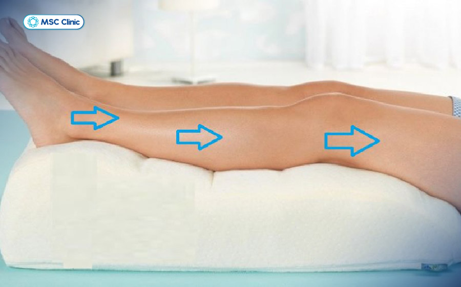 Kê cao vùng bị thương trong sơ cứu chấn thương phần mềm giúp hạn chế sưng