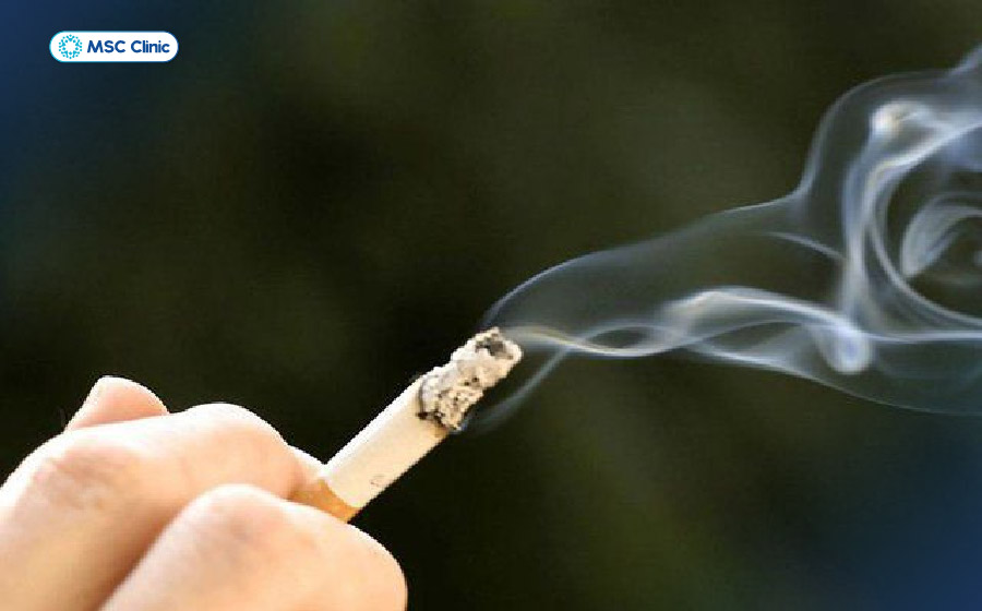 Khói thuốc lá là nguyên nhân gây tổn thương mạch máu nuôi xương Khói thuốc lá là nguyên nhân gây tổn thương mạch máu nuôi xương
