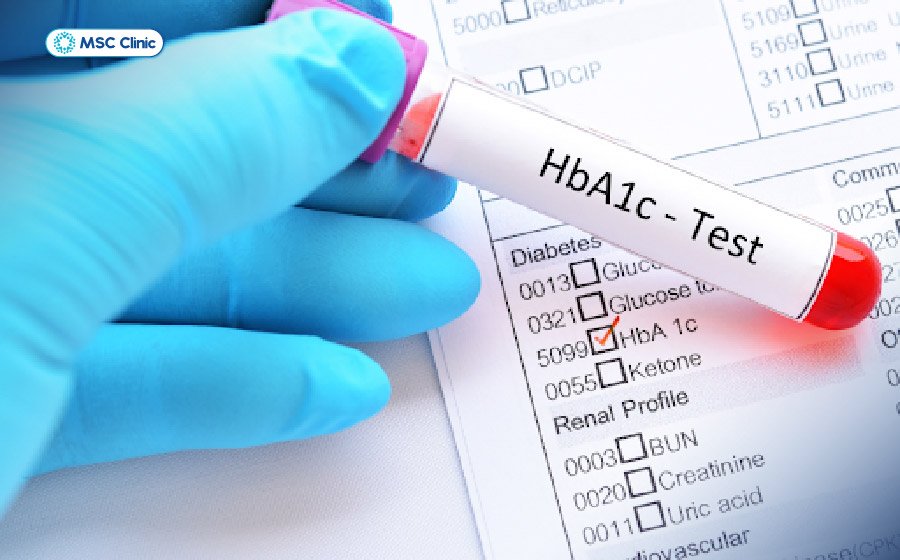 Kiểm soát tốt chỉ số HbA1c hỗ trợ giảm thiểu sự tích tụ mỡ trong tế bào gan Kiểm soát tốt chỉ số HbA1c hỗ trợ giảm thiểu sự tích tụ mỡ trong tế bào gan