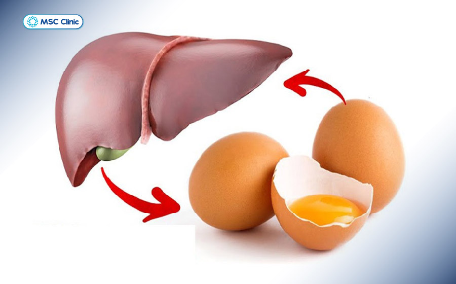 Men gan cao có ăn được trứng gà không cần được cân nhắc dựa trên nguyên nhân tăng men gan và chế độ ăn tổng thể Men gan cao có ăn được trứng gà không cần được cân nhắc dựa trên nguyên nhân tăng men gan và chế độ ăn tổng thể