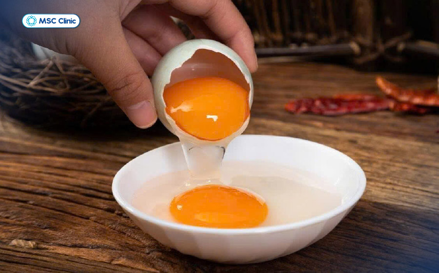 Men gan cao có nên ăn trứng cần được xem xét cùng lượng cholesterol, chất béo bão hòa và tổng năng lượng của khẩu phần Men gan cao có nên ăn trứng cần được xem xét cùng lượng cholesterol, chất béo bão hòa và tổng năng lượng của khẩu phần