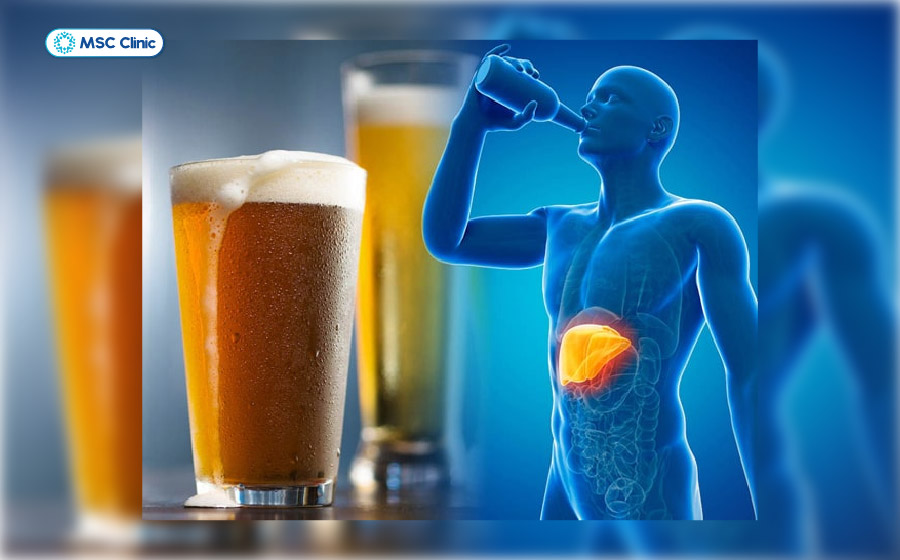 Men gan cao gặp ở những người thường xuyên sử dụng rượu bia