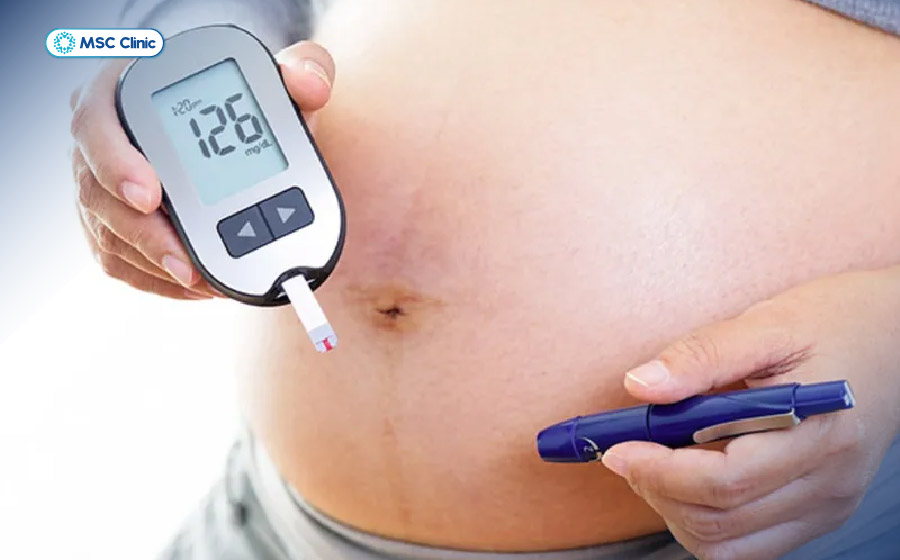 Người mắc tiểu đường type 2 không cần kiêng trứng hoàn toàn, nhưng nên cân đối lượng trứng với chế độ ăn và tình trạng mỡ máu Người mắc tiểu đường type 2 không cần kiêng trứng hoàn toàn, nhưng nên cân đối lượng trứng với chế độ ăn và tình trạng mỡ máu