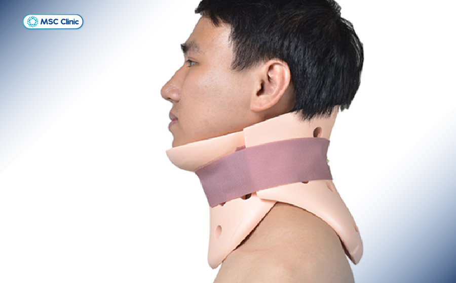Sử dụng nẹp cổ cứng để cố định và tránh gây tổn thương khi bị trật khớp cổ Sử dụng nẹp cổ cứng để cố định và tránh gây tổn thương khi bị trật khớp cổ