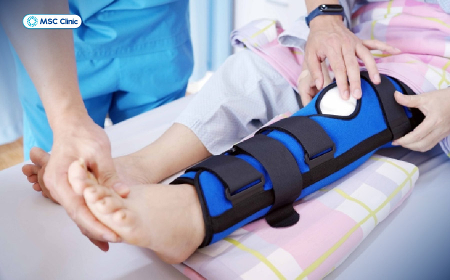 Sử dụng nẹp để bảo vệ đầu gối sau khi phẫu thuật chấn thương ACL