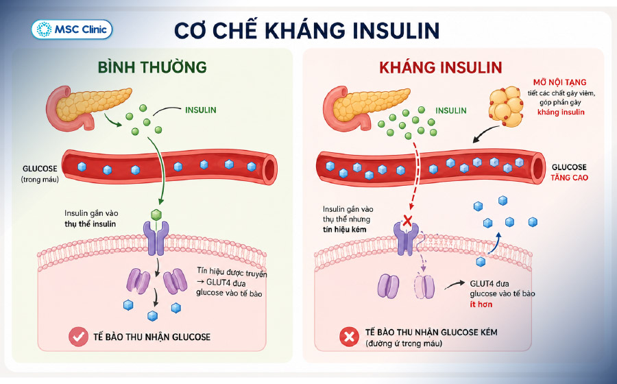 Tế bào giảm khả năng đáp ứng với insulin là nguyên nhân gây ra đái tháo đường Tế bào giảm khả năng đáp ứng với insulin là nguyên nhân gây ra đái tháo đường