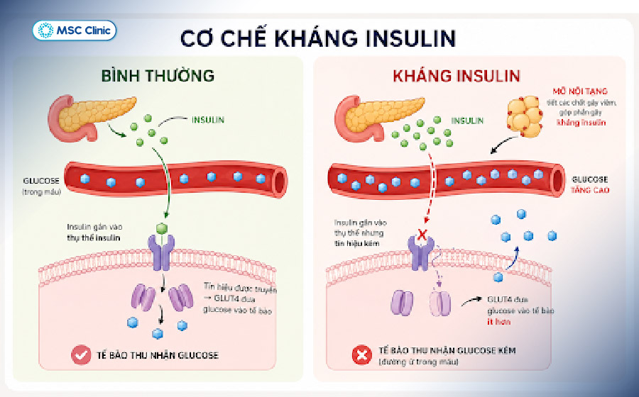 Tế bào giảm khả năng đáp ứng với insulin là nguyên nhân gây ra đái tháo đường Tế bào giảm khả năng đáp ứng với insulin là nguyên nhân gây ra đái tháo đường