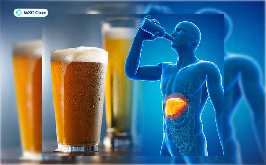 Tiêu thụ rượu bia kéo dài khiến tế bào gan liên tục chịu tổn thương, làm giảm dần khả năng hoạt động và phục hồi của gan Tiêu thụ rượu bia kéo dài khiến tế bào gan liên tục chịu tổn thương, làm giảm dần khả năng hoạt động và phục hồi của gan