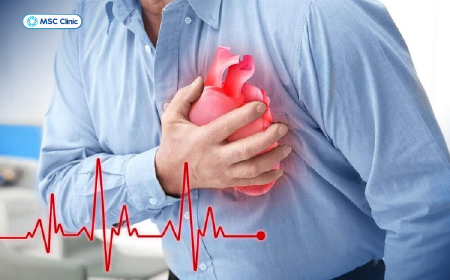 Tình trạng suy tim sung huyết có thể ảnh hưởng gây men gan cao