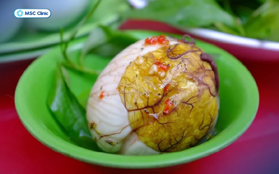 Trứng vịt lộn giàu dinh dưỡng, nhưng người mắc gút cần chú ý cách ăn để hỗ trợ kiểm soát axit uric Trứng vịt lộn giàu dinh dưỡng, nhưng người mắc gút cần chú ý cách ăn để hỗ trợ kiểm soát axit uric