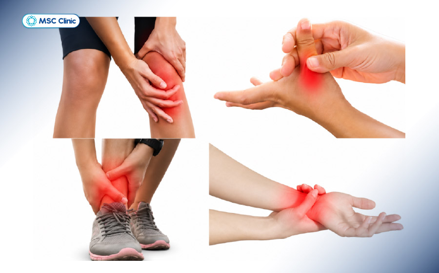 Vị trí các khớp thường bị bong gân Vị trí các khớp thường bị bong gân