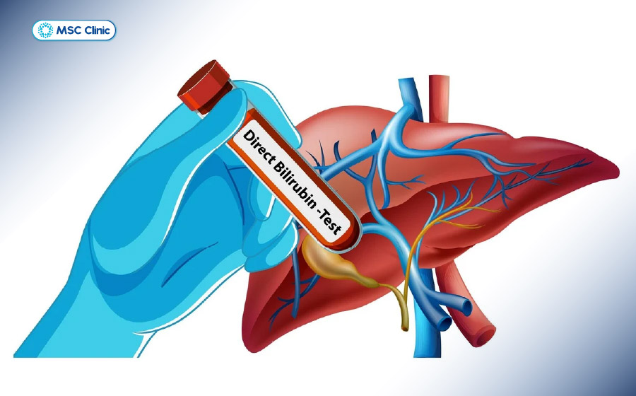 Xét nghiệm Bilirubin đánh giá khả năng chuyển hóa và bài tiết của gan mật Xét nghiệm Bilirubin đánh giá khả năng chuyển hóa và bài tiết của gan mật