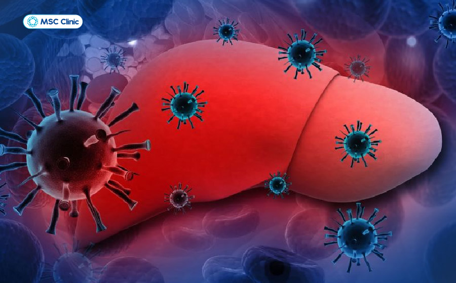 Xét nghiệm viêm gan virus là bước cần thiết để tìm nguyên nhân khi men gan tăng kéo dài Xét nghiệm viêm gan virus là bước cần thiết để tìm nguyên nhân khi men gan tăng kéo dài