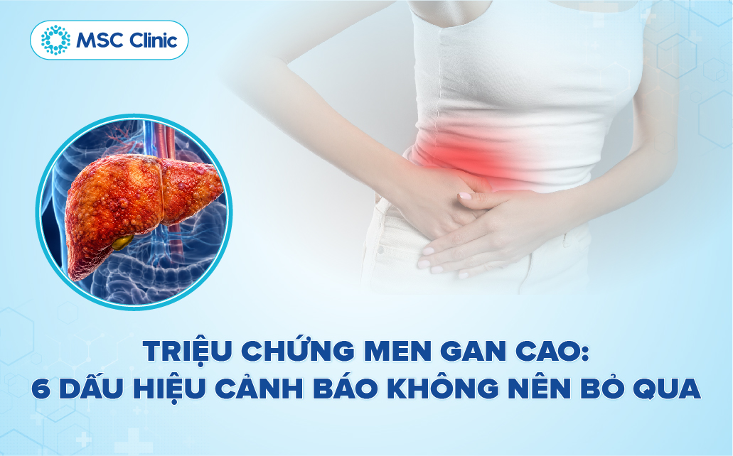 6 triệu chứng men gan cao không nên bỏ qua: Khi nào cần khám?