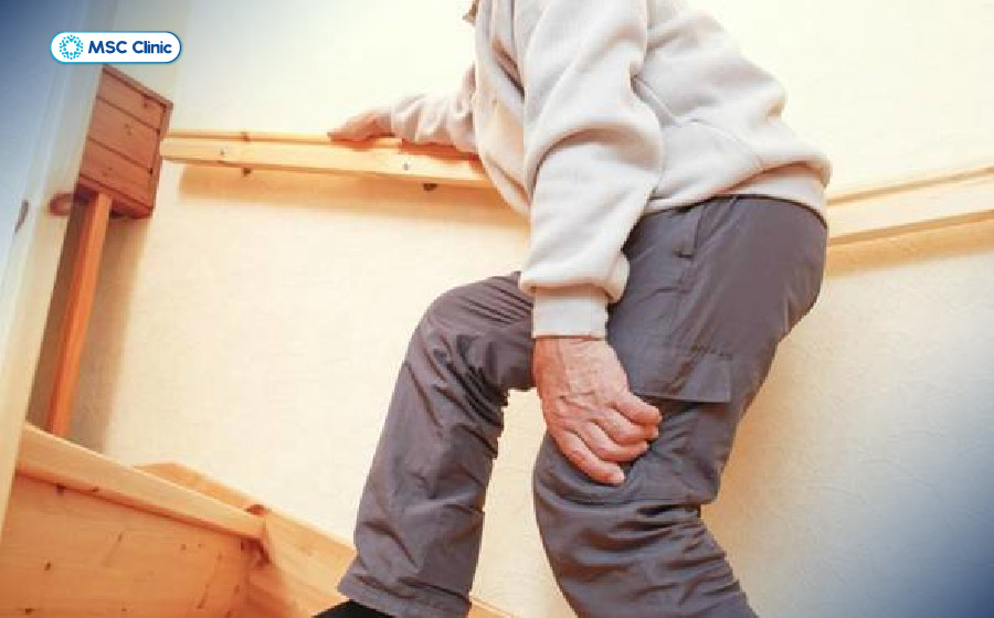 Bệnh thấp khớp có thể gây đau, sưng, cứng khớp và ảnh hưởng đáng kể đến khả năng vận động