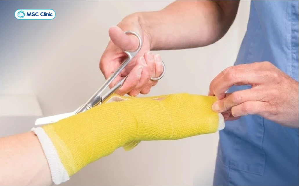 Cần lập tức tháo bột cố định chi để giải phóng chèn ép