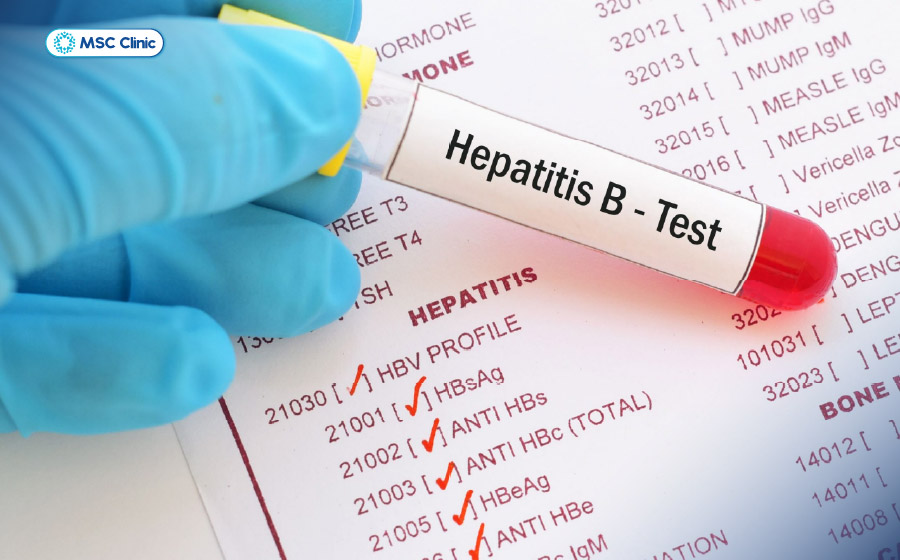 HBsAg giúp xác định tình trạng nhiễm HBV ở thời điểm làm xét nghiệm