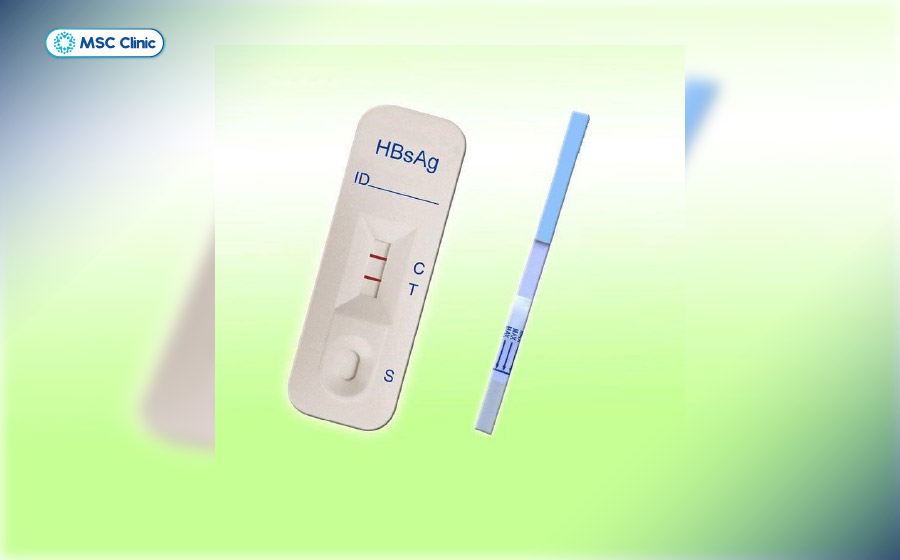 HBeAg dương tính thường liên quan đến tình trạng virus đang nhân lên và khả năng lây truyền cao hơn 