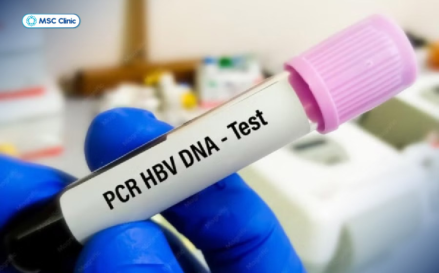 Định lượng HBV-DNA giúp đánh giá tải lượng virus trong máu