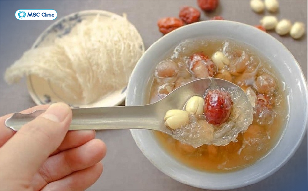 Bệnh nhân tiểu đường cần chú ý khẩu phần nước yến sử dụng phù hợp với nhu cầu và tình trạng sức khỏe
