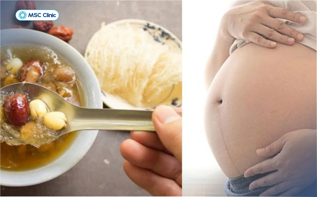 Phụ nữ mắc tiểu đường thai kỳ cần tham khảo ý kiến bác sĩ trước khi sử dụng nước yến