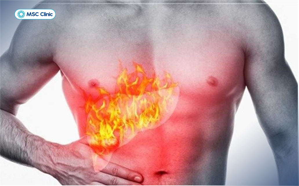 Nhiều người thường nói về cảm giác bị nóng gan