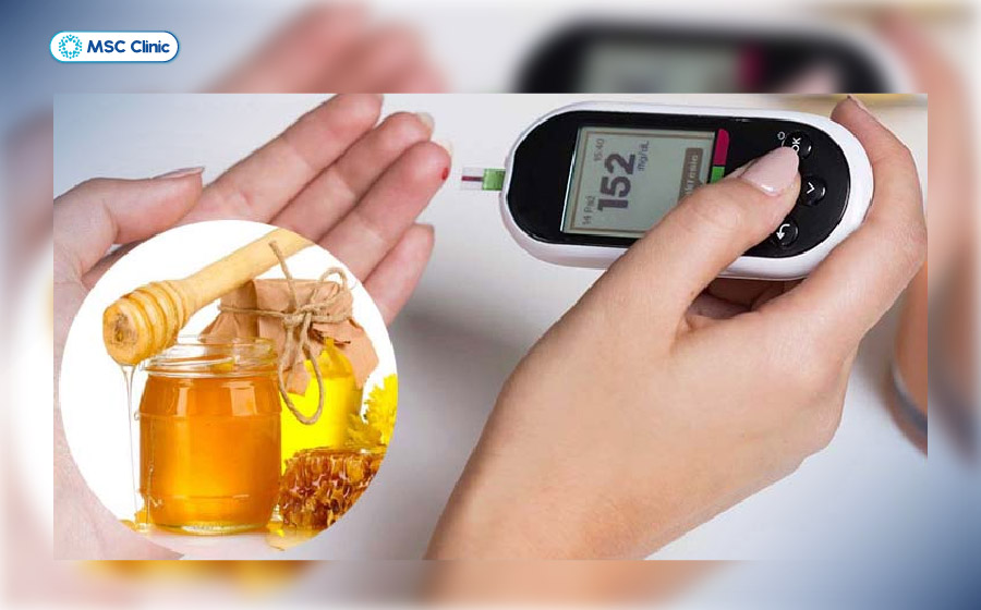 Người bị tiểu đường có uống được mật ong không phụ thuộc vào khả năng kiểm soát đường huyết và tổng lượng carbohydrate trong chế độ ăn
