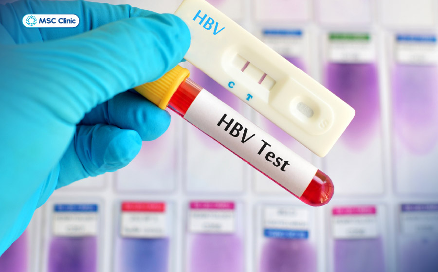 Xét nghiệm các dấu ấn HBV kết hợp đánh giá chức năng gan giúp bác sĩ xác định tình trạng bệnh