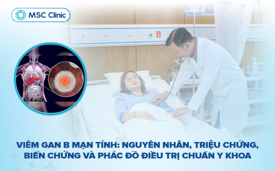 Viêm gan B mạn tính: Nguyên nhân, triệu chứng, biến chứng và phác đồ điều trị chuẩn y khoa
