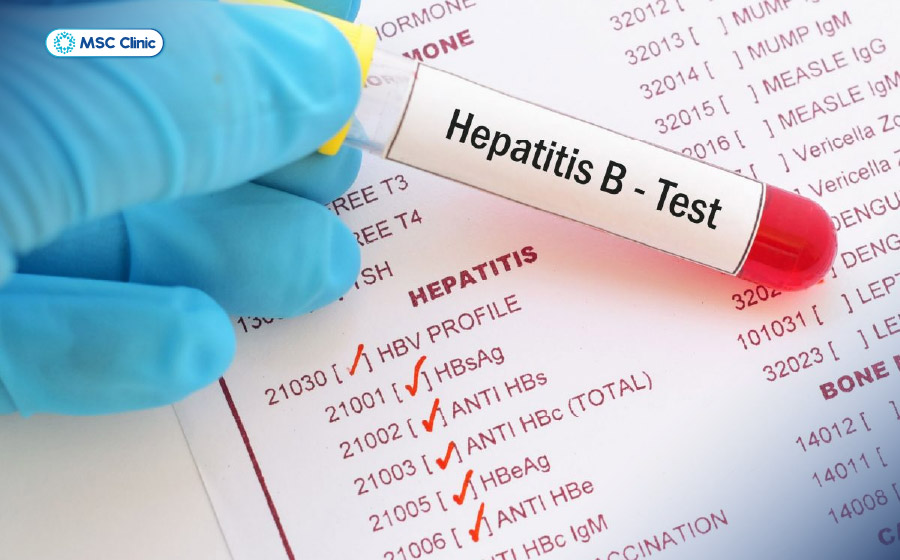 HBsAg là dấu ấn quan trọng để xác định tình trạng nhiễm HBV