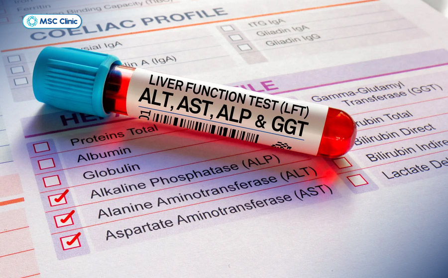 ALT và AST giúp đánh giá tình trạng tổn thương tế bào gan