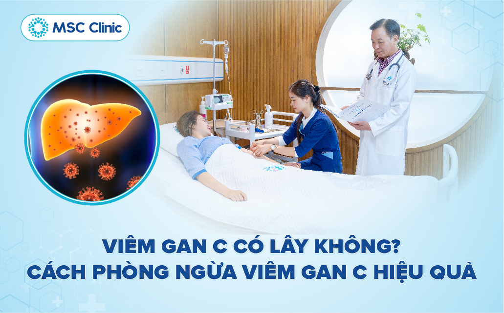 Viêm gan C có lây không? Cách phòng ngừa viêm gan C hiệu quả