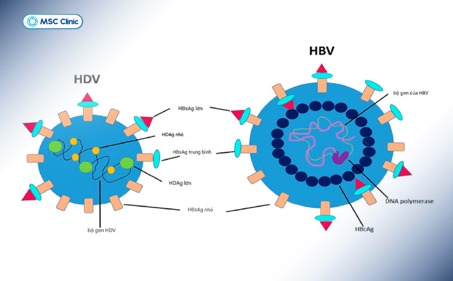 Viêm gan D do virus Hepatitis D - HDV gây ra, chỉ khởi phát khi có sự hiện diện của HBV