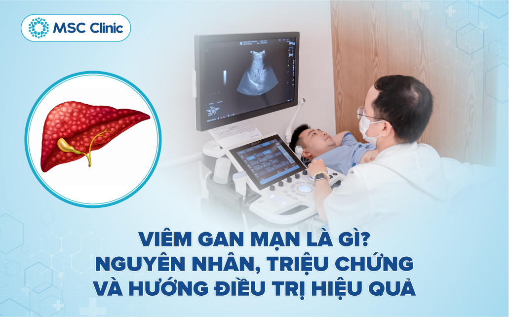 Viêm gan mạn là gì? Nguyên nhân, triệu chứng và hướng điều trị hiệu quả