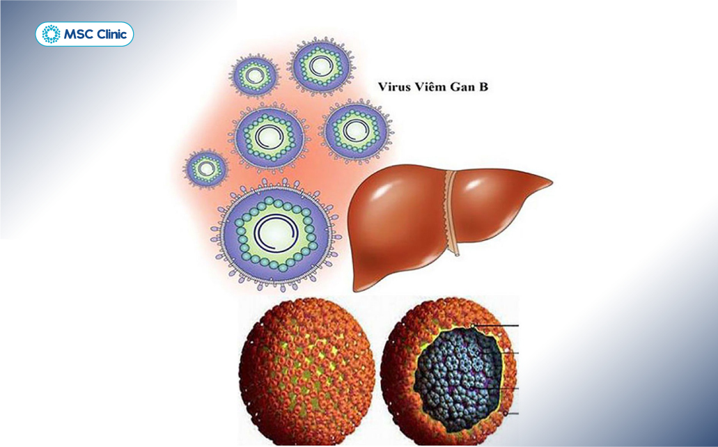 HBV có khả năng tồn tại dai dẳng trong cơ thể và gây tổn thương gan kéo dài nếu không được kiểm soát