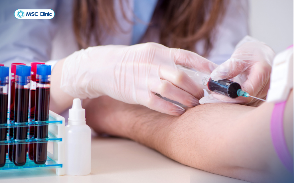 Xét nghiệm máu giúp phát hiện dấu hiệu tổn thương gan và hỗ trợ xác định nguyên nhân viêm gan