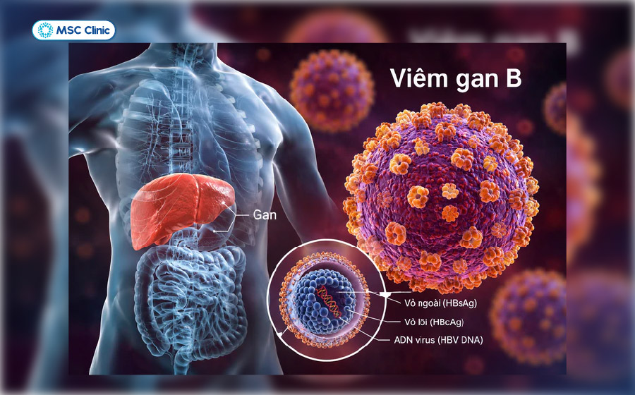 Viêm gan B là loại phổ biến và dễ lây lan