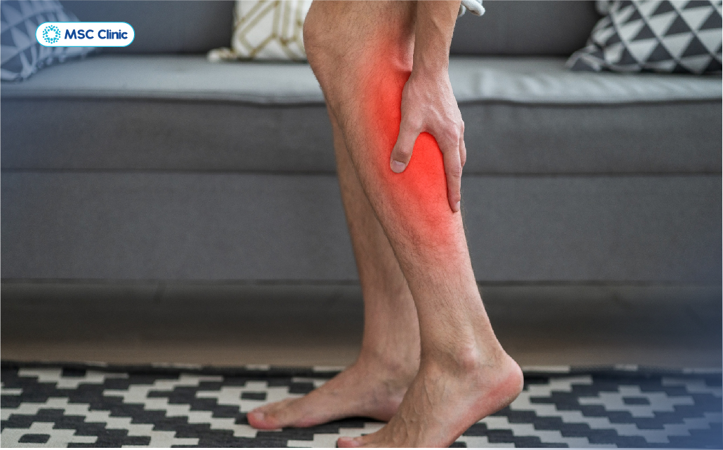 Vùng cẳng chân là vị trí dễ xảy ra hội chứng chèn ép khoang nhất