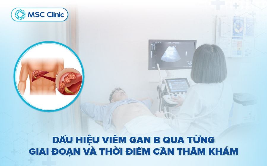 Dấu hiệu viêm gan B qua từna giai đoạn và thời điểm cần thăm khám